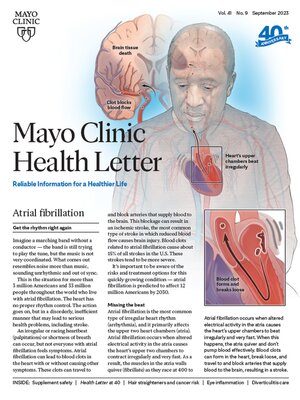 cover image of September 2023. Mayo Clinic Health Letter